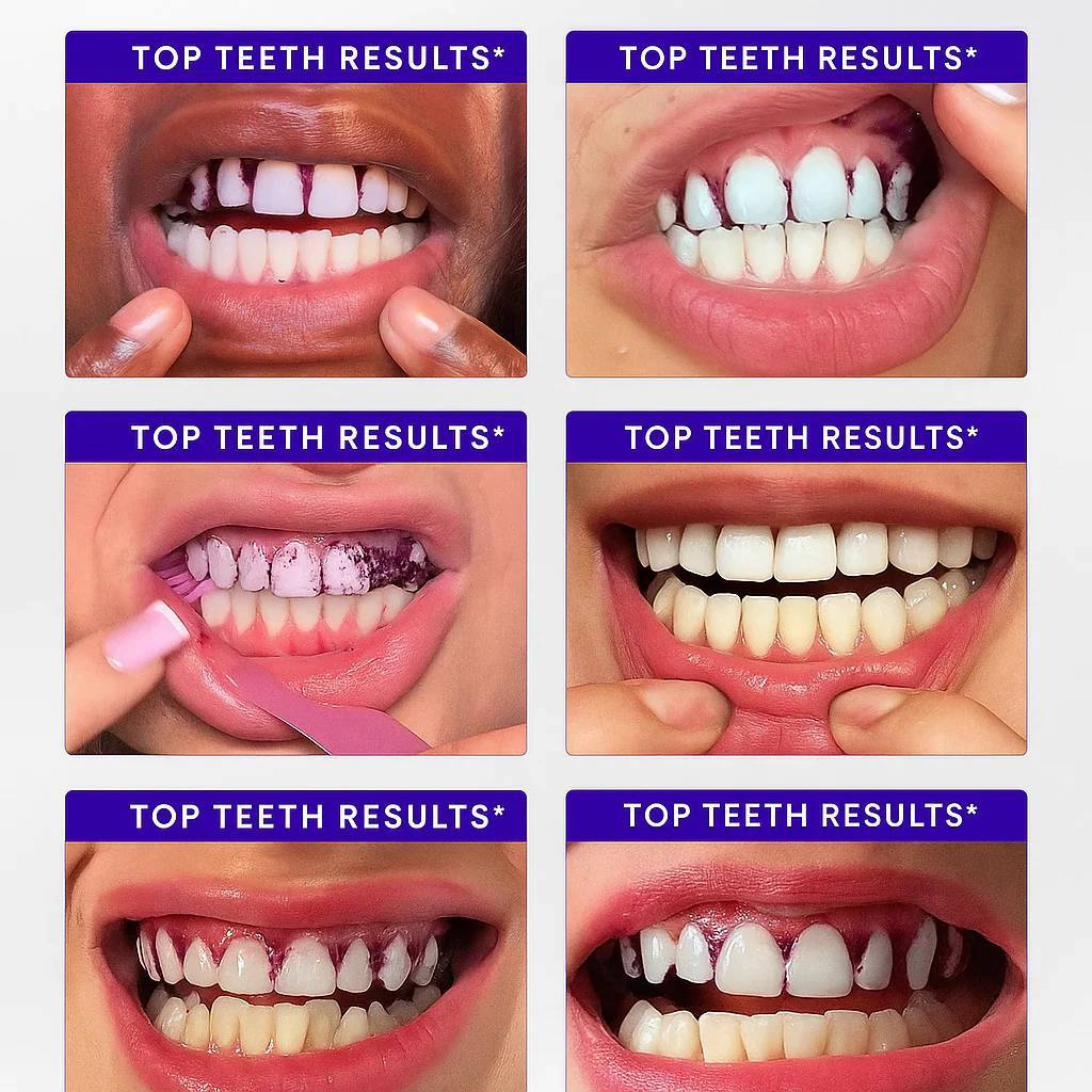 Pure'Aera Purple Teeth Whitening Strips™