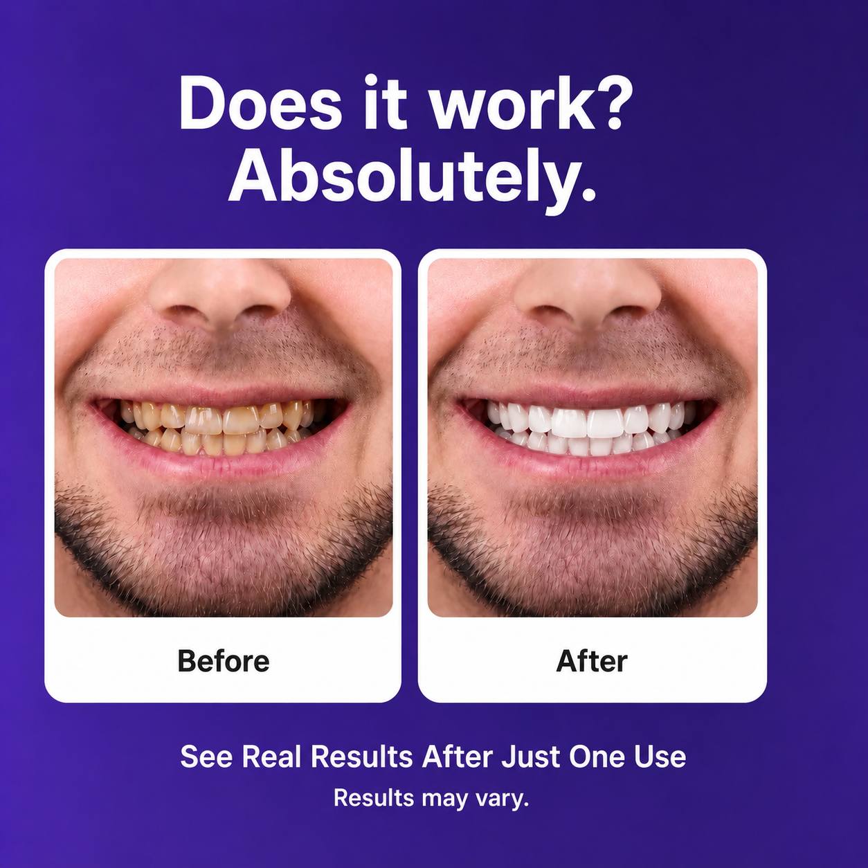 Pure'Aera Purple Teeth Whitening Strips™